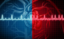 Load image into Gallery viewer, End of AFIB: Comprehensive Test Panel