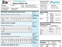 Load image into Gallery viewer, Zio Patch Heart Monitor